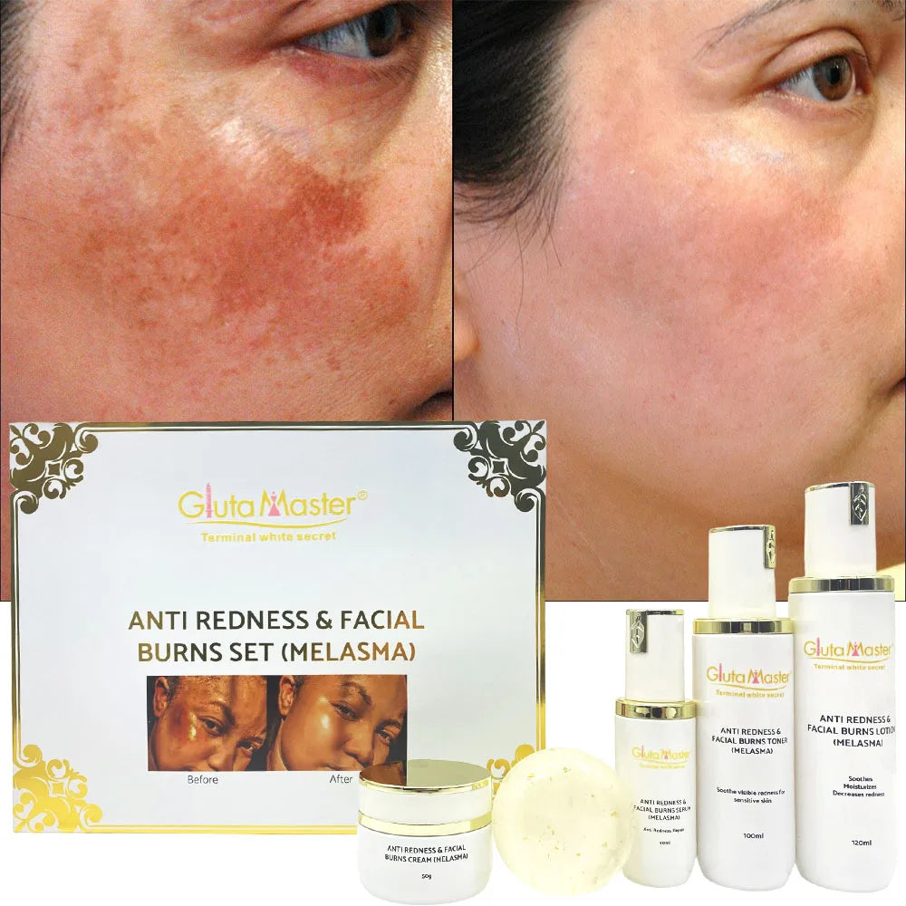 Gluta Master Anti Redness & Facial Burns Set Remove Melasma & Hyperpigmentation with Vitamine C Moisturizing Lightening Skin Set